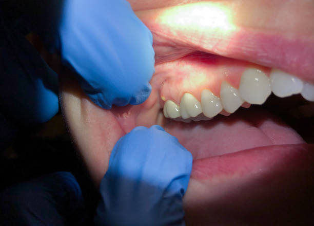 Best Orthodontic Emergency Dentist in Amberley, OH